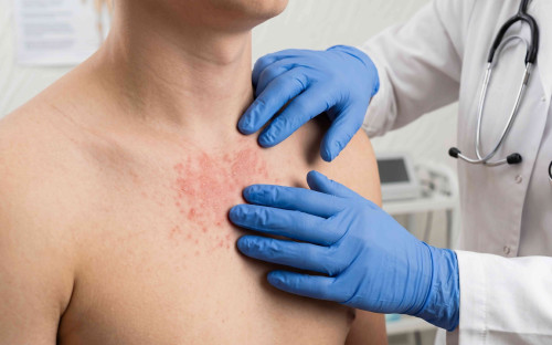 Dermatoses fréquentes – Formation DPC médecin